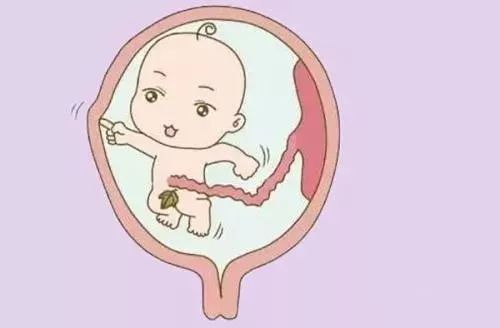 怀孕第九个月的胎儿图，怀孕第九个月要注意什么。