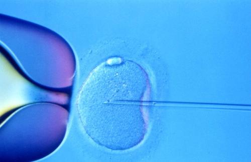 高龄助孕产子花费_为什么美国的试管婴儿胚胎移植后会失败？
