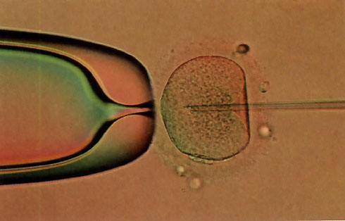 40岁二代试管婴儿流程-卵泡生长影响体外受精*。