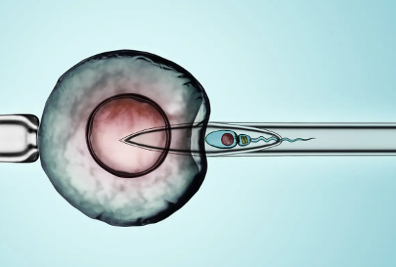 在广东申请捐献精子的体外受精有什么要求？捐赠者精子的体外受精程序解释!