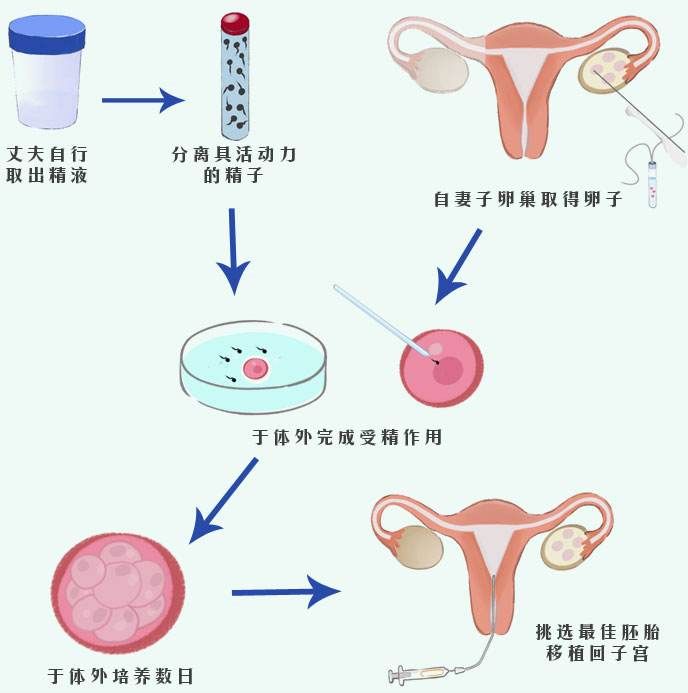 徐州49岁供卵：26岁时卵巢储备功能不足的表现是什么？卵巢功能不全